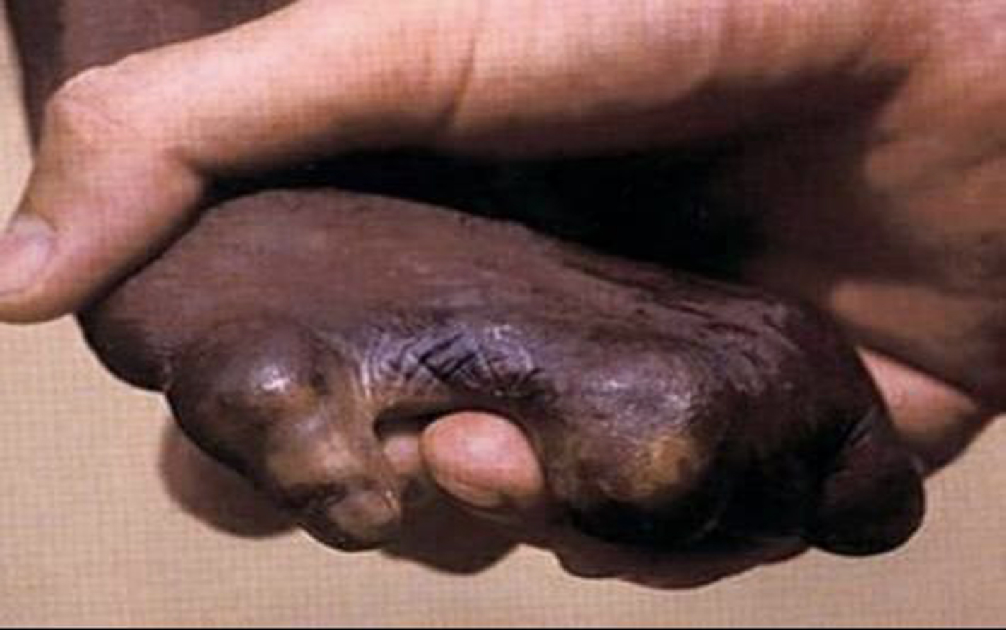 Leprosy village Mahenge img3